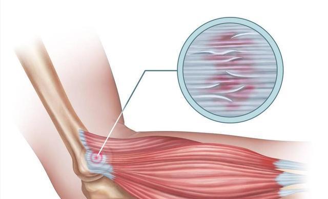 比如局部超, 这些方法不